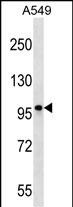 CCDC141 (N-term)