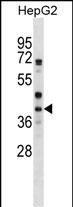 WNT6