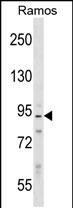 PPP1R9B (N-term)