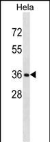 RNF34