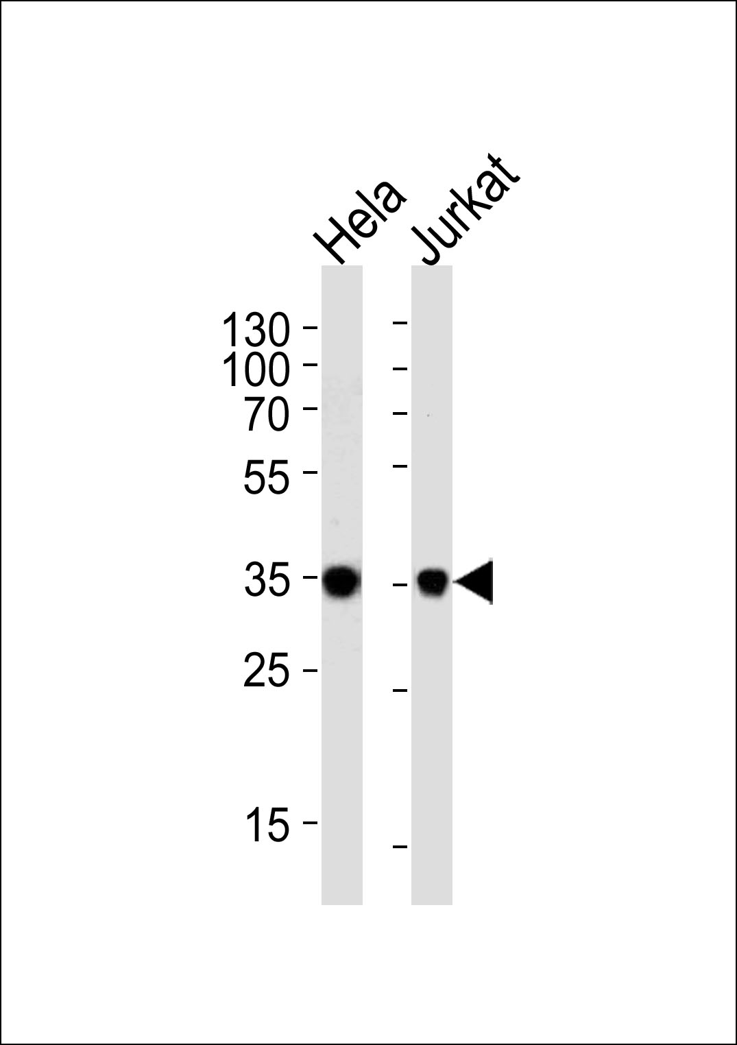 FRG1