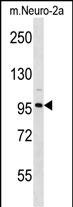 Rabbit Polyclonal Antibody to CLCN2 (N-term)