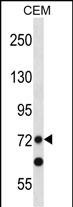 PRDM8 (N-term)