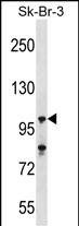 USP16 (N-term)