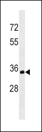 MS4A1/CD20