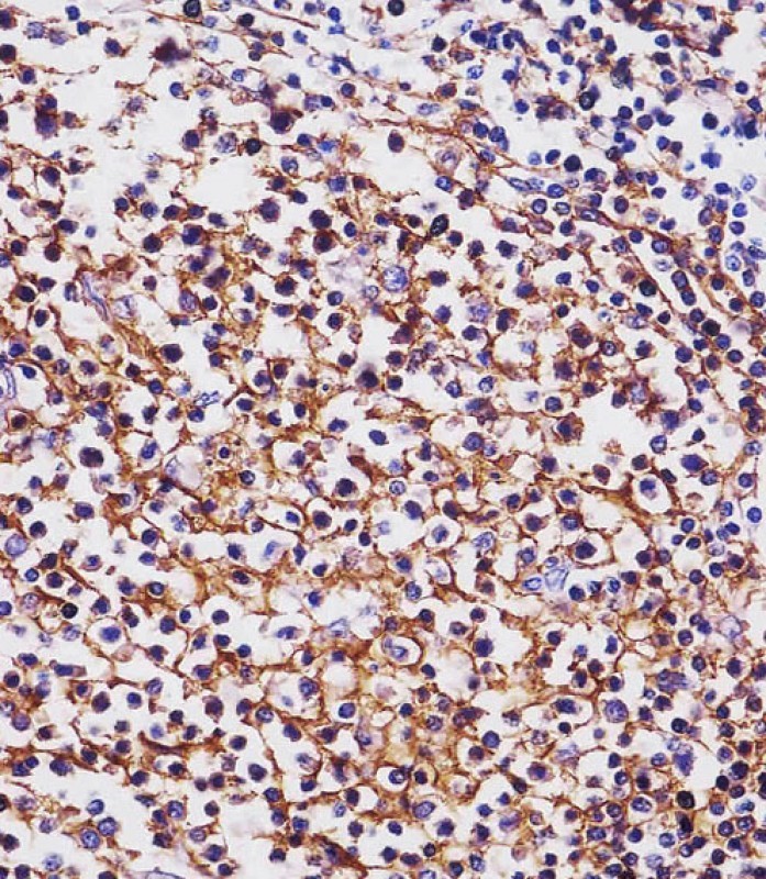 Mouse Monoclonal Antibody to MS4A1/CD20