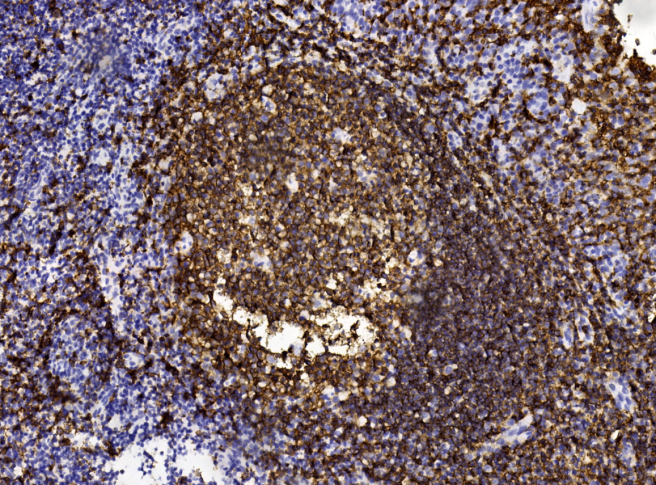 Mouse Monoclonal Antibody to MS4A1/CD20