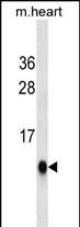 UBL5(Ascites)