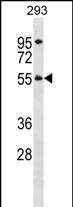 TTC8 (N-term)