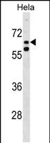 KLHL38 (N-term)