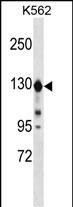 ESYT1