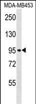 FBXO11 (N-term)