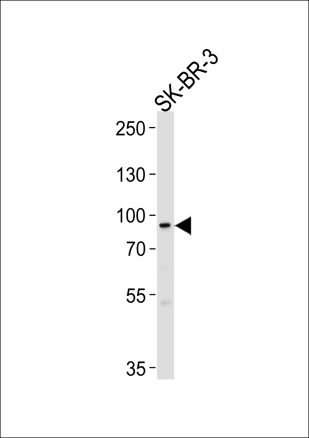 MTIF2 (N-term)