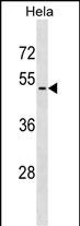 VIPR2 (N-term)