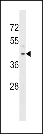 RRM2B