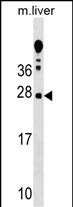 Rabbit Polyclonal Antibody to TRAT1