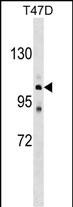 ATP2C1