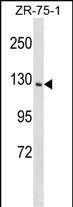 PITPNM1 (N-term)