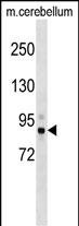 Mouse Tbk1 (N-term)