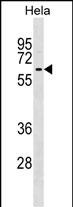 Rabbit Polyclonal Antibody to KLHL12