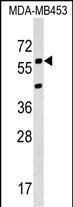 KCNS3 (N-term)