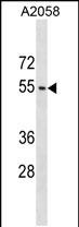 ACTL9 (N-term)