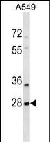 SNF8 (N-term)