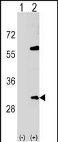 Rabbit Polyclonal Antibody to SNF8 (N-term)