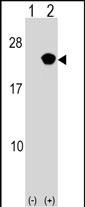 Rabbit Polyclonal Antibody to RAP2B