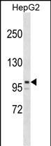 ARID5B