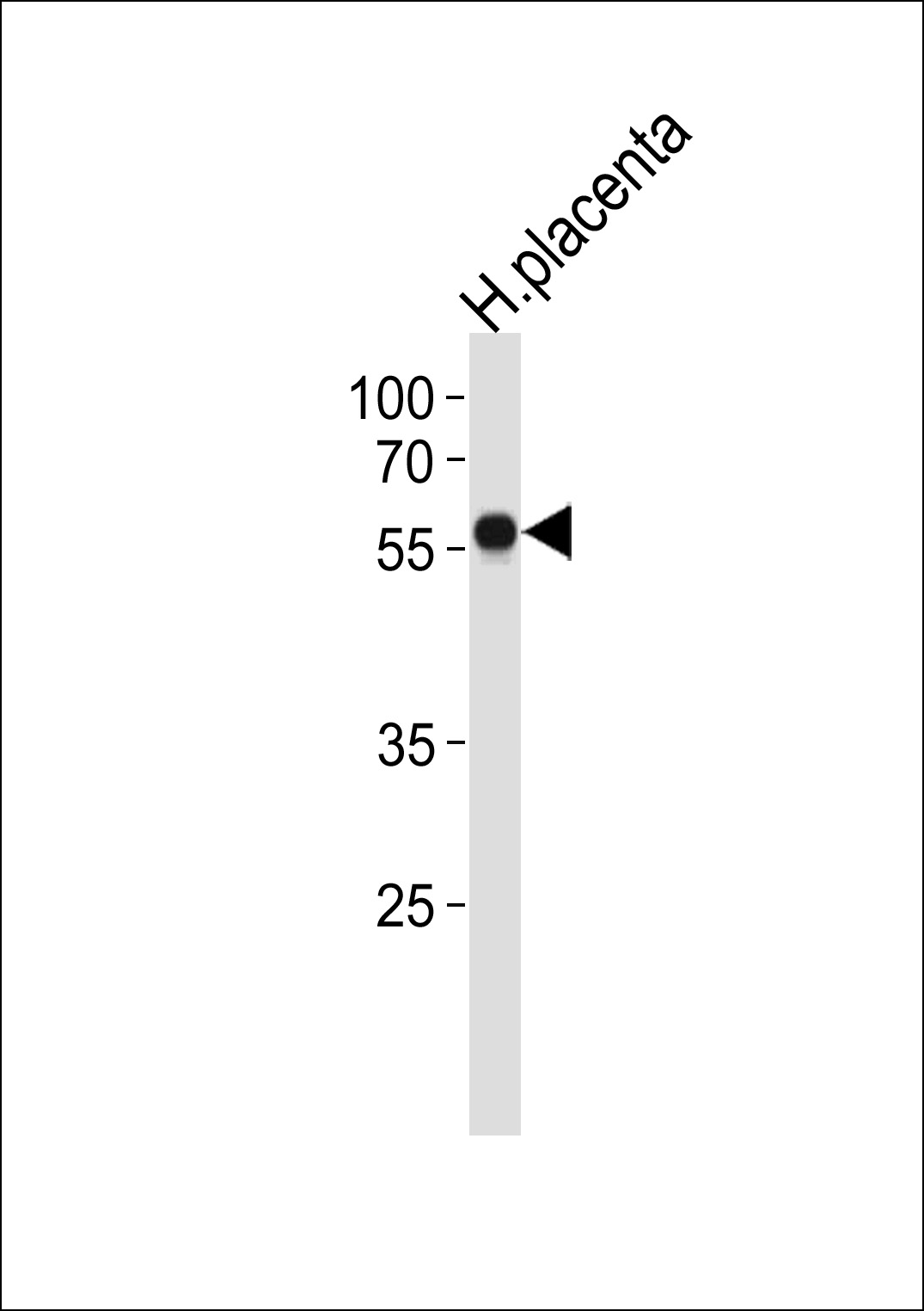 ZNF71 (N-term)