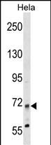 MTMR14 (N-term)