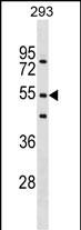 FBXW9 (N-term)