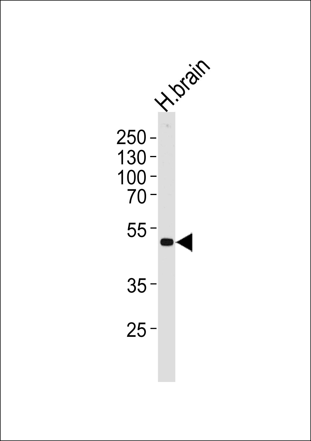 KCNJ12