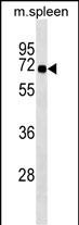 Rabbit Polyclonal Antibody to SNTB1