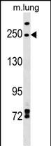 INF2