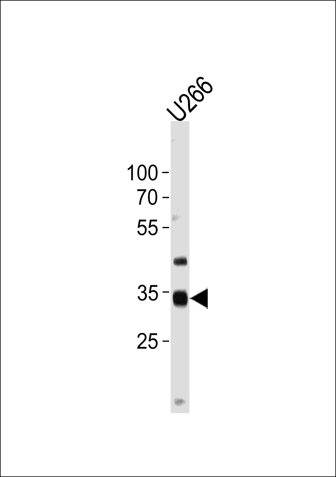 NKX3-2