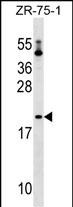 PTRH1