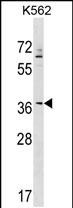 ZNF385A (N-term)