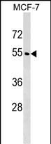 WDR20 (N-term)