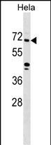 ZNF280B (N-term)