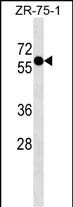 ZNF503 (N-term)