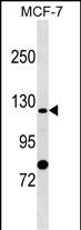 SLC4A9 (N-term)