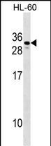 CGB2 (N-term)