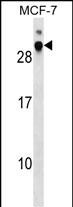 Rabbit Polyclonal Antibody to DNAJB9 (N-term)