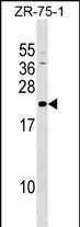 GRPEL1