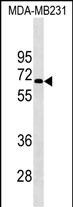 KCNF1