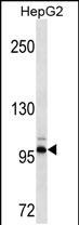 DDR2(Ascites)