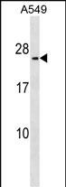 METTL7B (N-term)