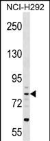 CRTAC1 (N-term)